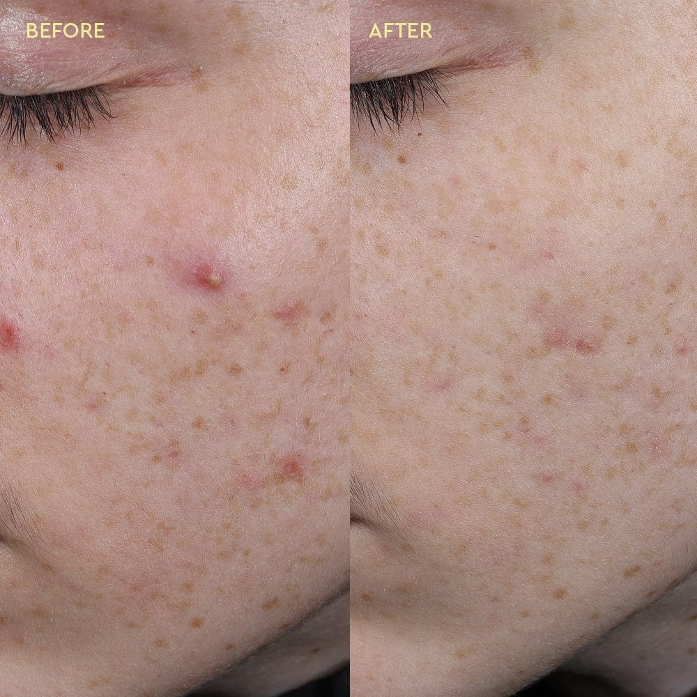 Blemish Clearing Paste - Image 6